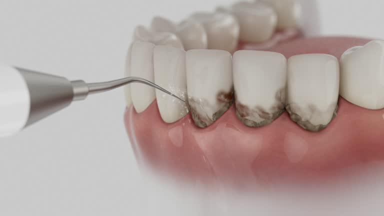 Trusted Emergency Dentist service in Cape Coral, FL - Dentist Open Now